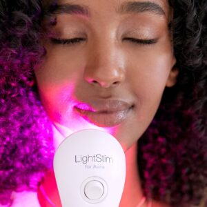 LightStim for Acne